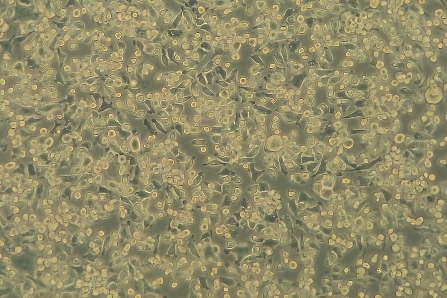 Intact host cells (NCTC) before virus contact (100 x). © 2025  DITF