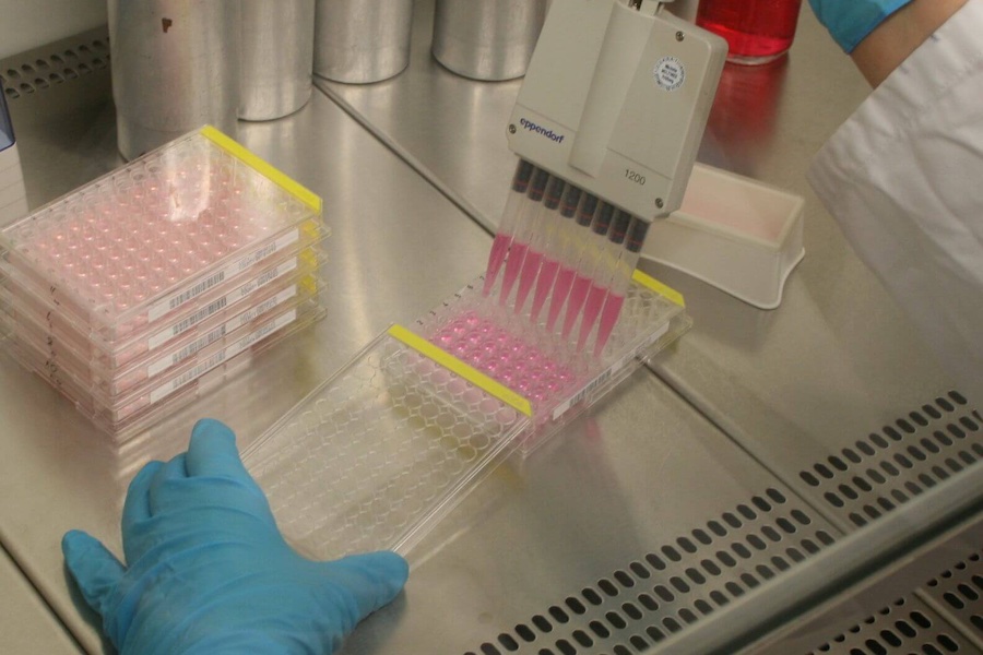 Cell seeding of host cells to determine the number of viruses. © 2025 DITF